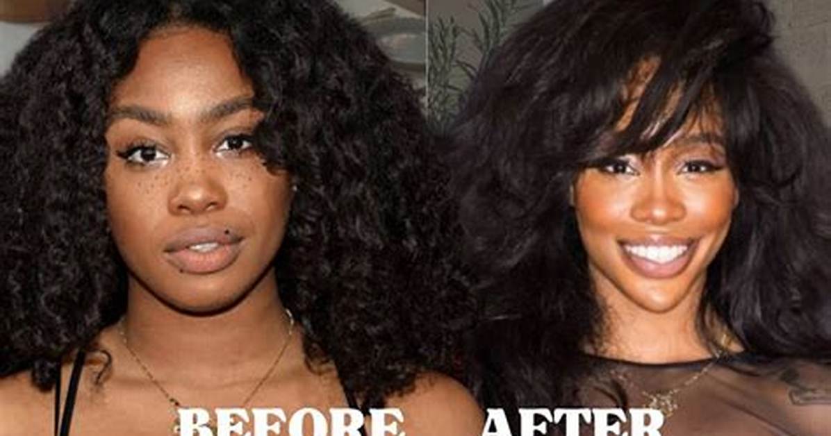 A Comprehensive Guide for Sza Before Surgery