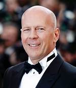Celebrating the Iconic Bald Famous Actors