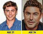 Did He Get Surgery? Before and After Pics, Age and Height |