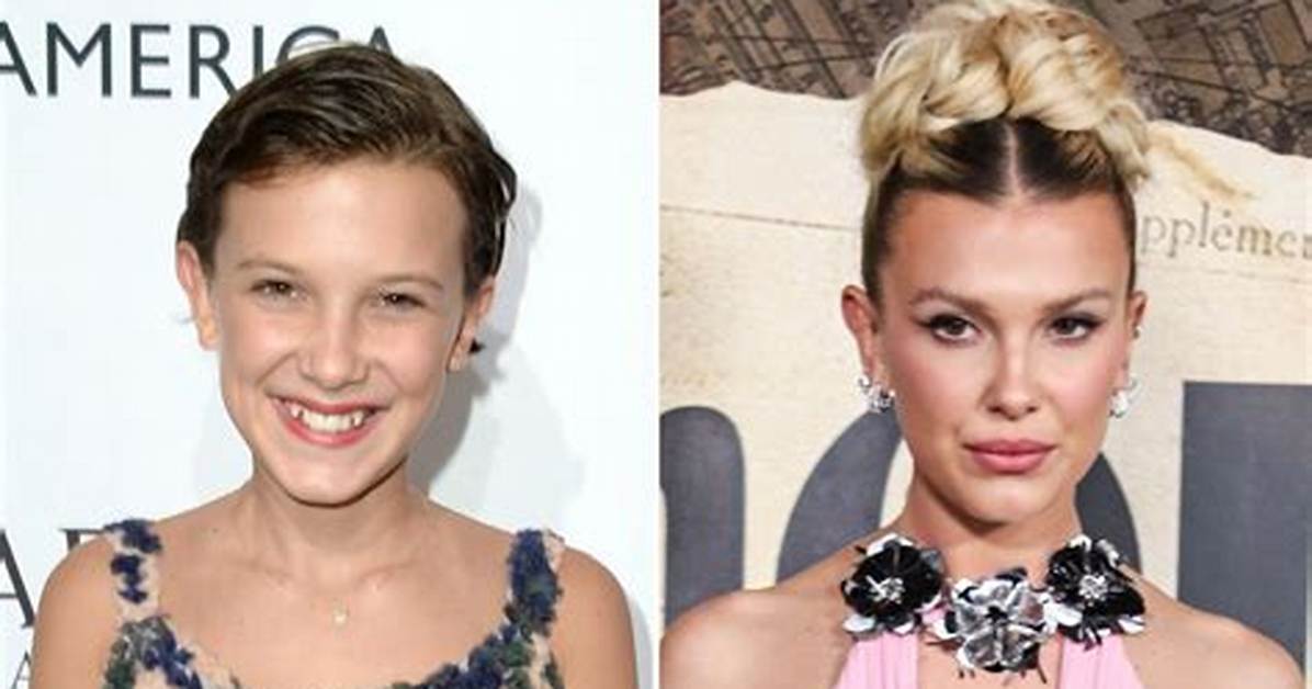How Did Millie Bobby Brown Look Before and After Plastic Surgery