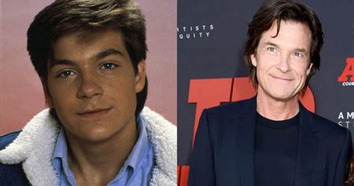 Jason Bateman Plastic Surgery: Before & After!