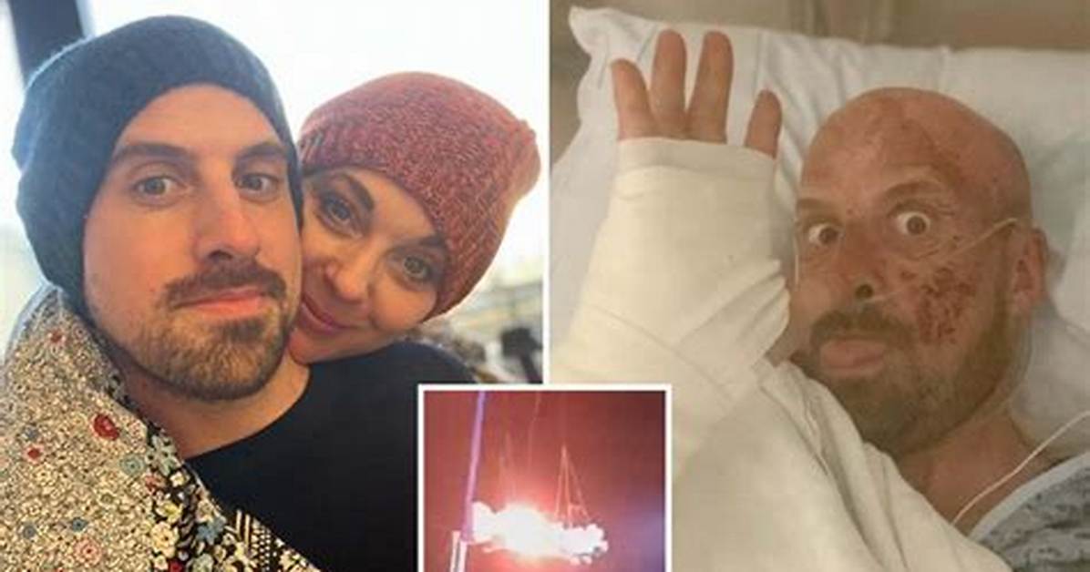 Jonathan Goodwin Spent Months in Hospital After Agt Extreme Accident Mon 28 February 2022 15:13
