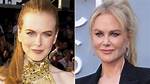 Nicole Kidman: the Truth Behind Her Face Surgery Rumors