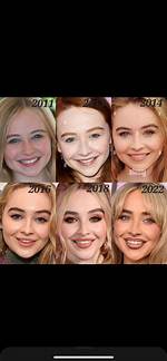Sabrina Carpenter's Lip Filler: Exploring the Transformation