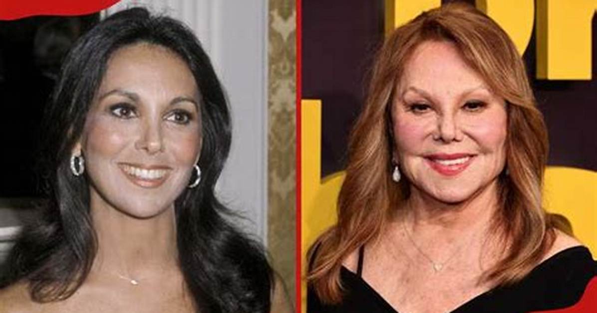 The Truth Behind Marlo Thomas' Facial Transformation