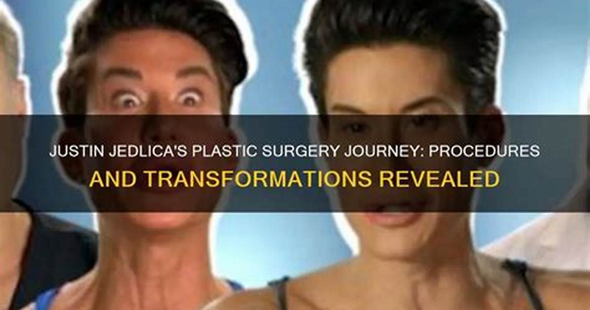 Transformations and Controversies: the Journey of Justin Jedlica in Plastic Surgery