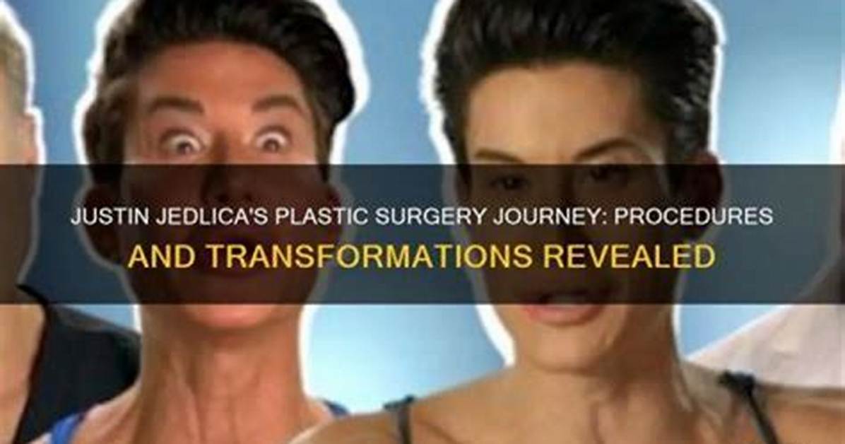 Transformations and Revelations: the Before and After of Kimberly Guilfoyle