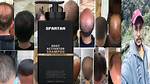Ultimate Spartan Hair Shampoo Reviews: Unleashing the Power of Nature for Your Hair