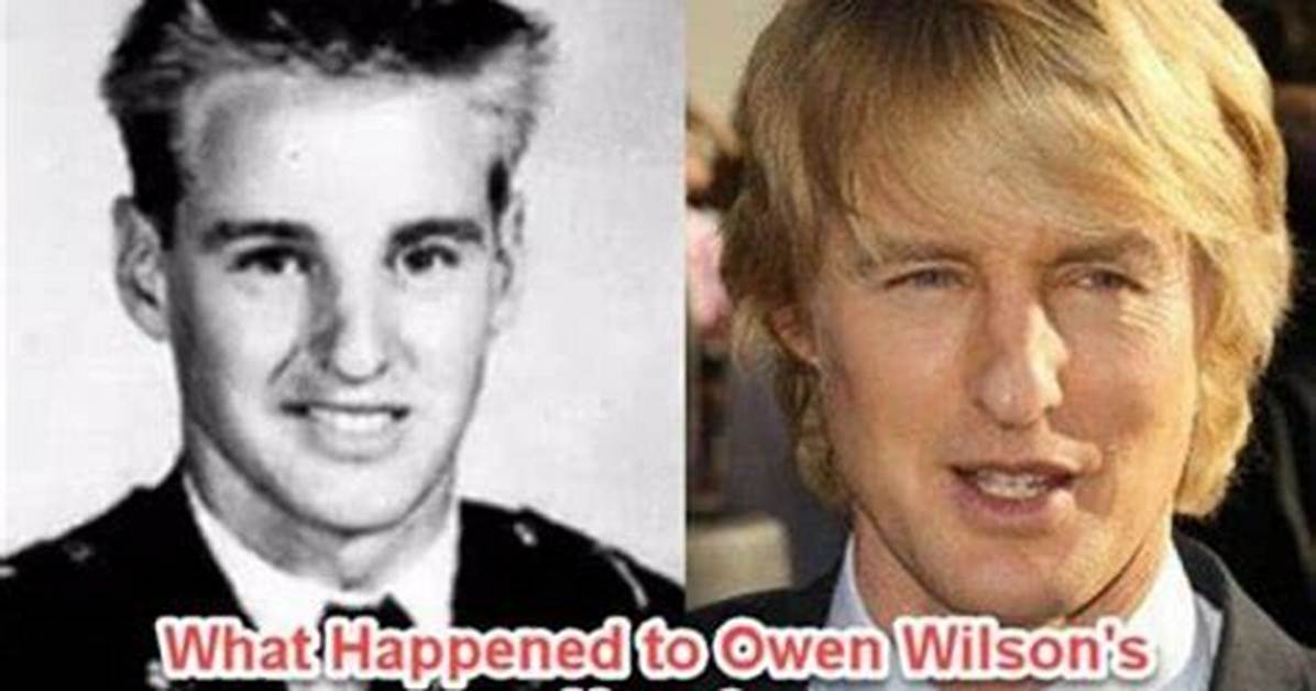 What Really Happened to Owen Wilsons Nose and How Did He Break It? ·